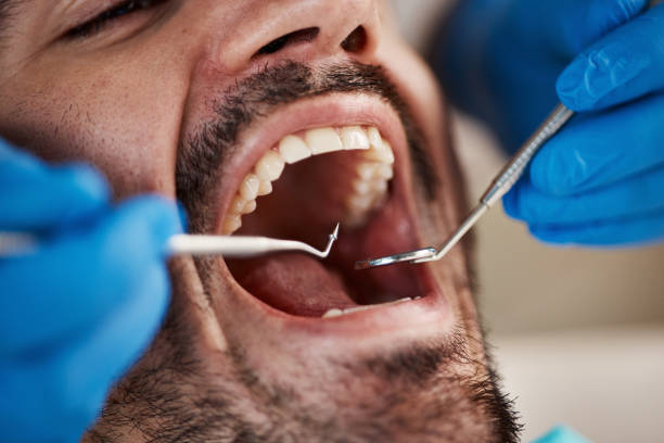 Best Weekend Emergency Dentist in Ocean City, FL